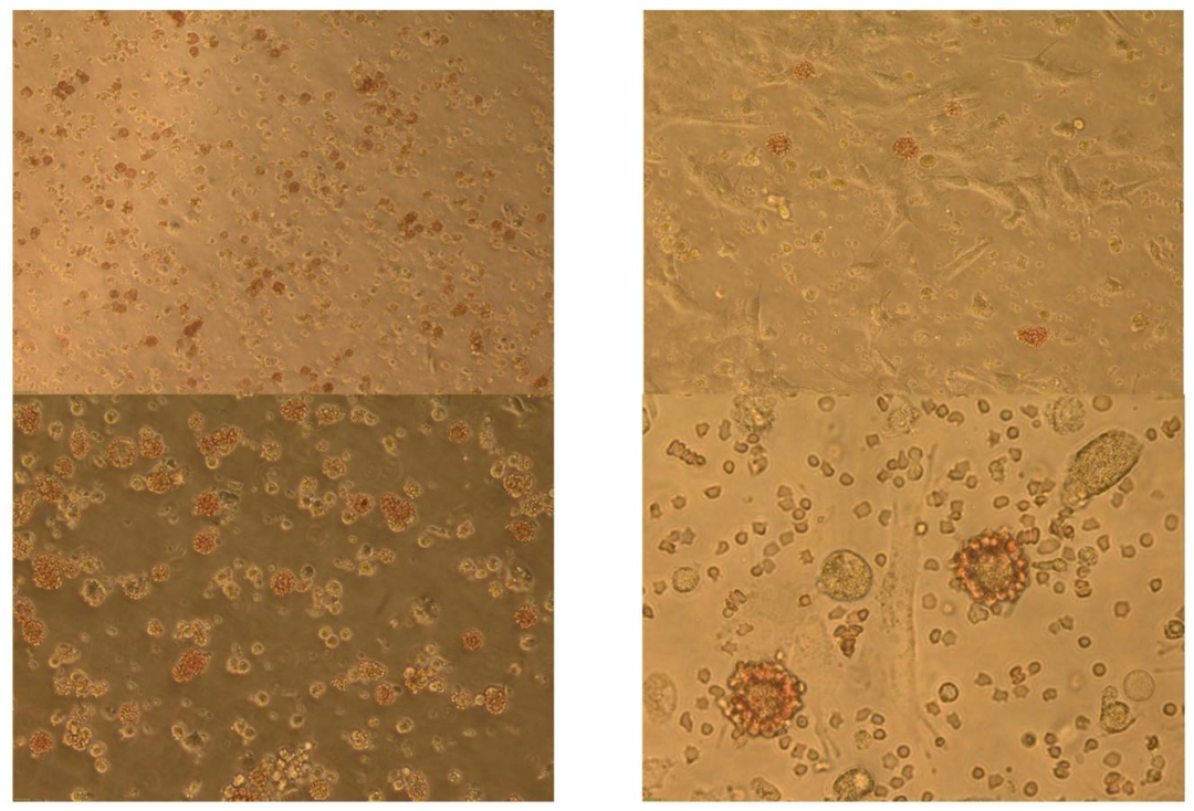 Fig4：ASFV 感染后的血吸附现象