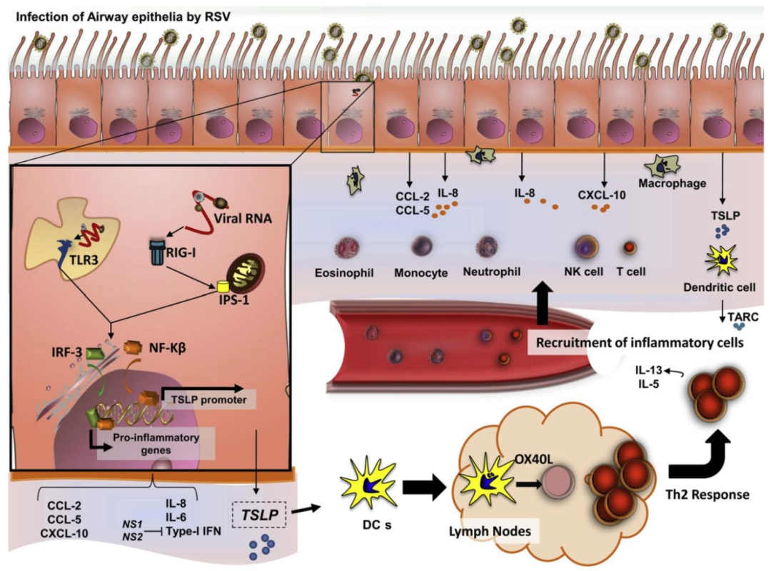 Fig4：RSV 感染 AECs 的免疫反应模型