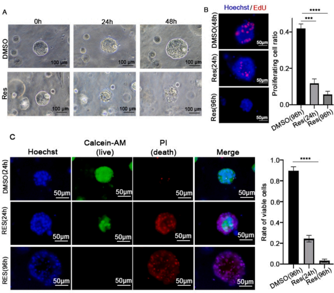 图2白藜芦醇抑制乳腺癌类器官生长