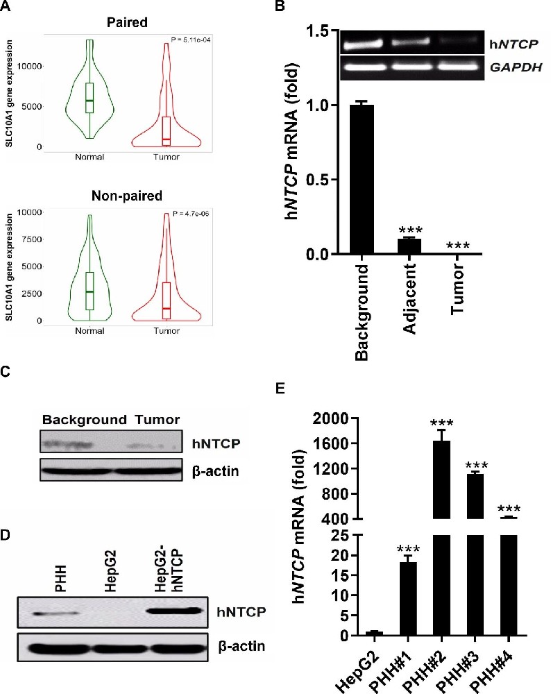 图 1：hNTCP 在肝癌组织和 HepG2 细胞中表达下调