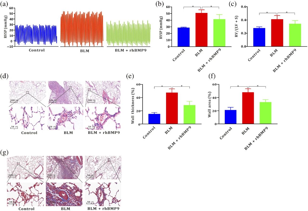 图 6：rhBMP9 治疗改善博来霉素诱导的肺动脉高压及肺纤维化