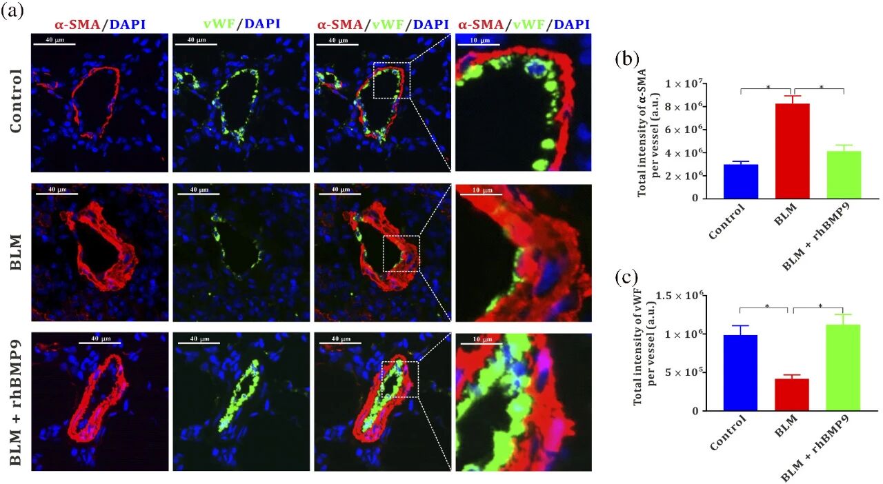 图7：rhBMP9 保护博来霉素诱导的肺动脉内皮损伤