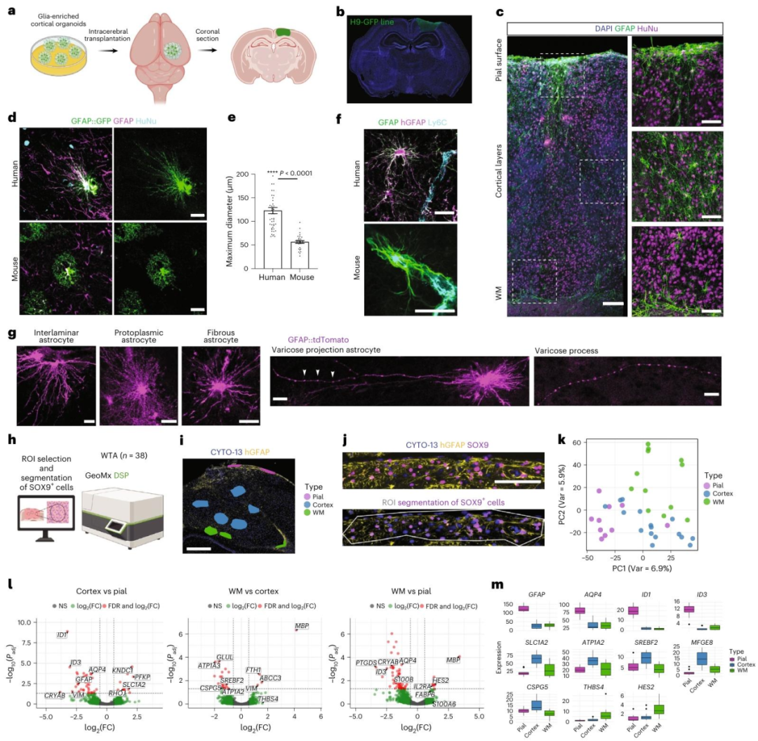 图 2：体内移植后人类星形胶质细胞形成形态学亚型