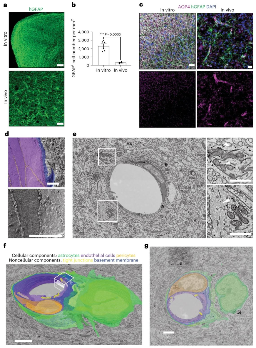 图 3：人类星形胶质细胞形成血管周围足突