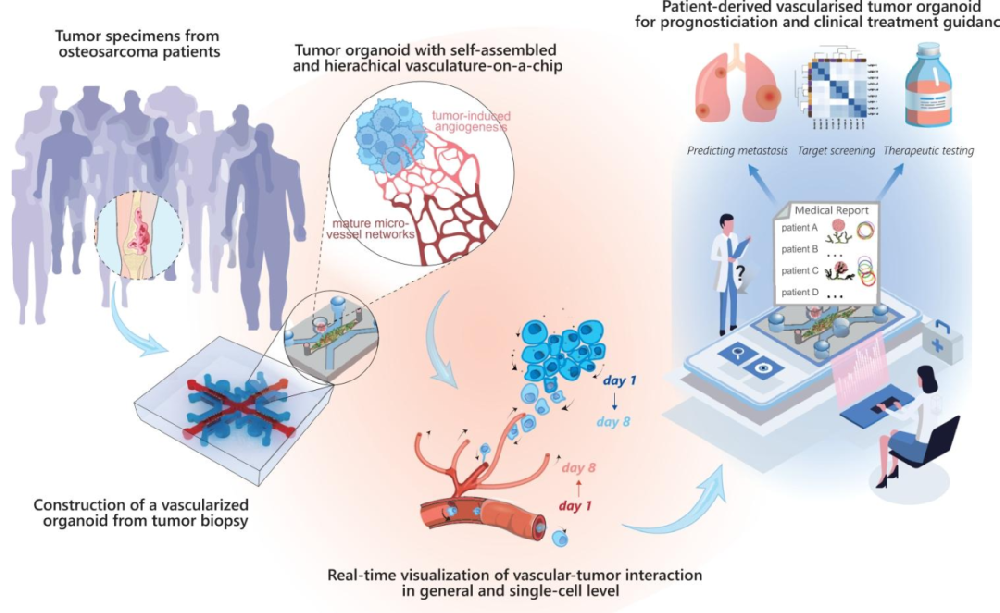 图1:血管化患者来源类器官研究示意图