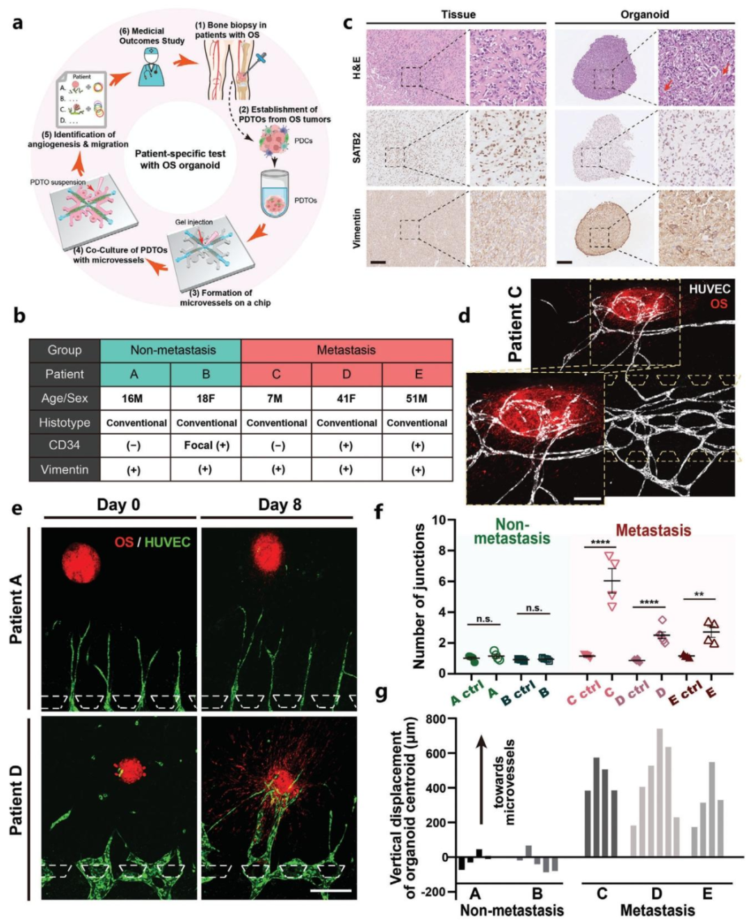 图4:PDTO 的转移潜能与临床结果关联
