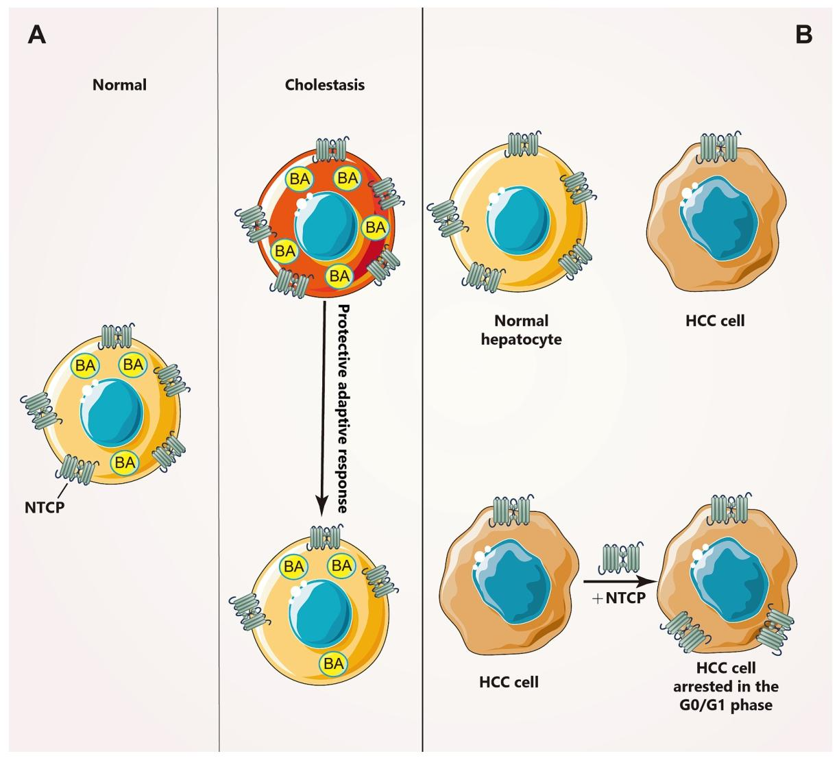 图 2：肝疾病中 NTCP 的表达变化规律