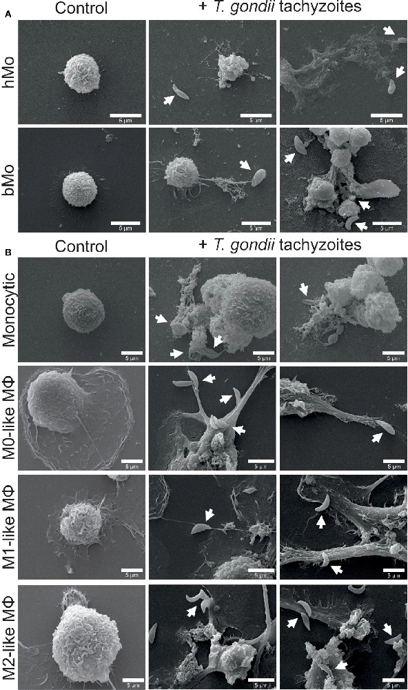 图 1:弓形虫诱导单核吞噬细胞的形态变化