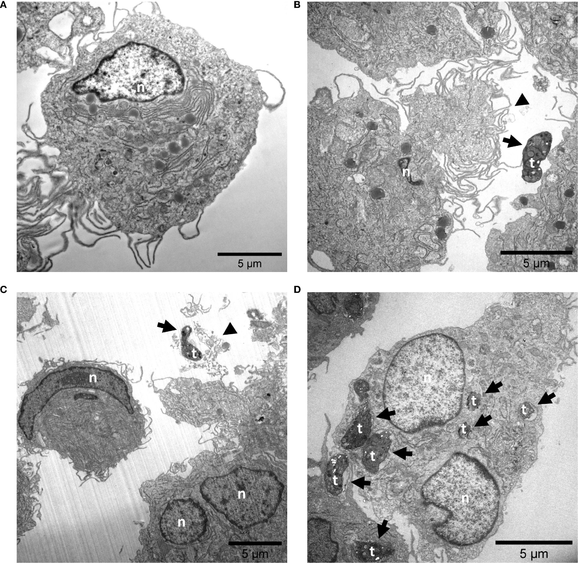 图 2:M1 型巨噬细胞的 ET 样结构释放及弓形虫内化