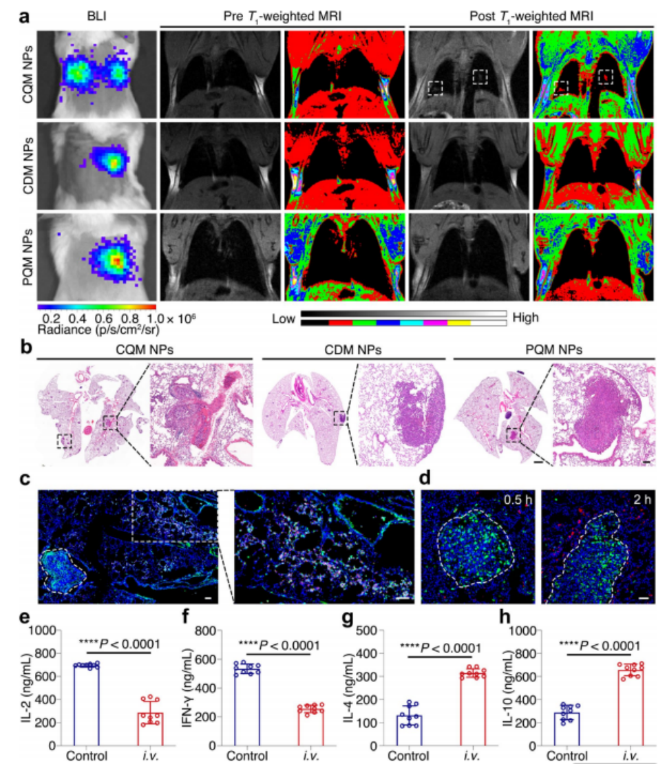图 2 使用巨噬细胞搭载的CQM纳米颗粒对超小转移性肺肿瘤进行MRI检测