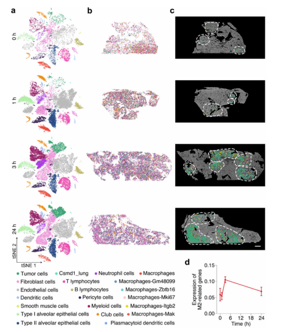 图3 肺转移性肿瘤内及周围巨噬细胞极化的空间转录组分析