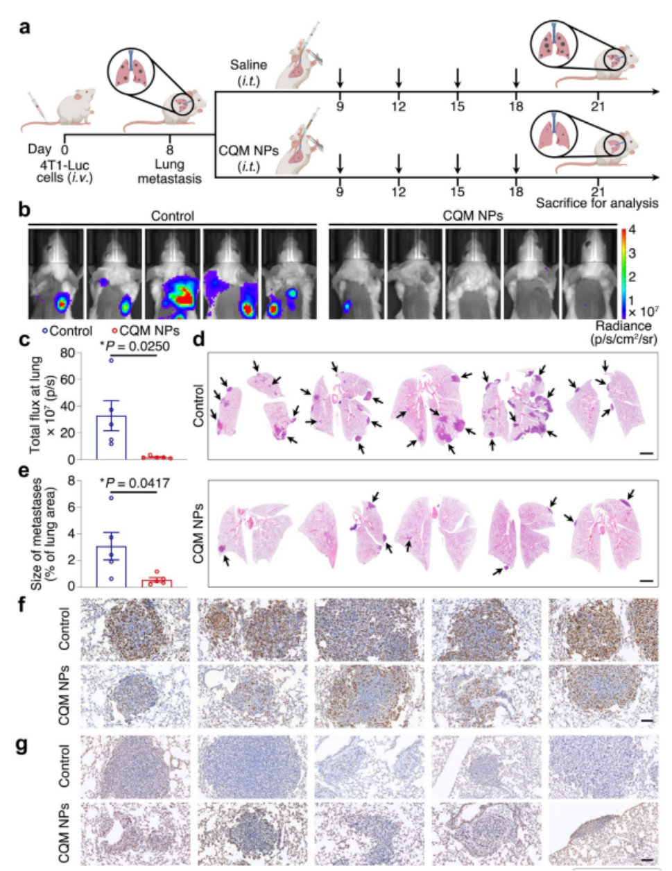 图6 通过CQM纳米颗粒(NPs)进行肺转移瘤抗肿瘤治疗的腹腔(i.t.)给药策略