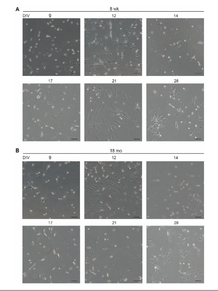 Fig1:成年与老年小胶质细胞培养过程中的形态变化