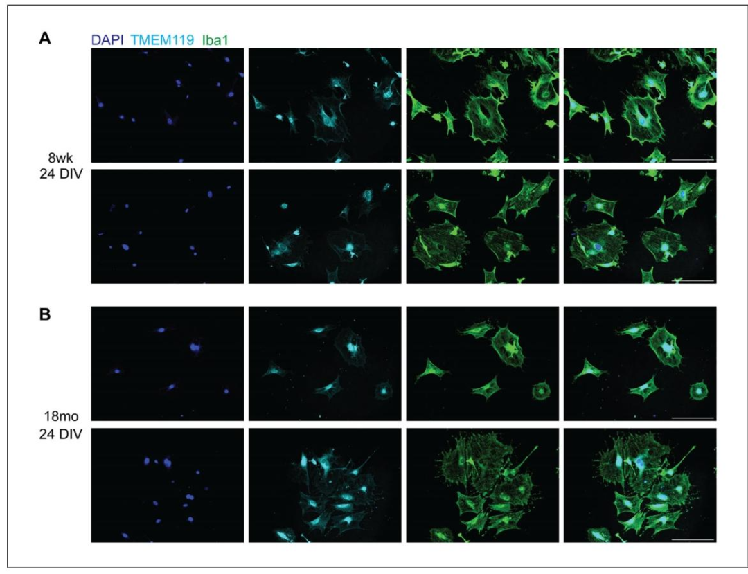 Fig2:成年与老年小胶质细胞的纯度鉴定(免疫荧光)