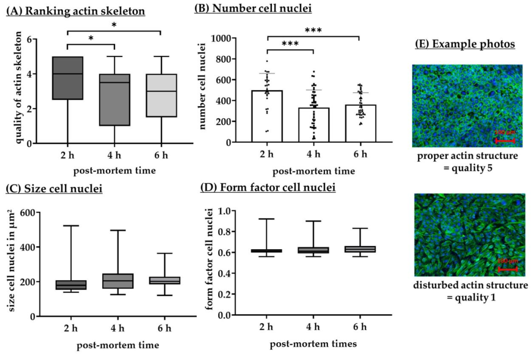 Fig7：PMT 对 RPE 细胞核参数的影响