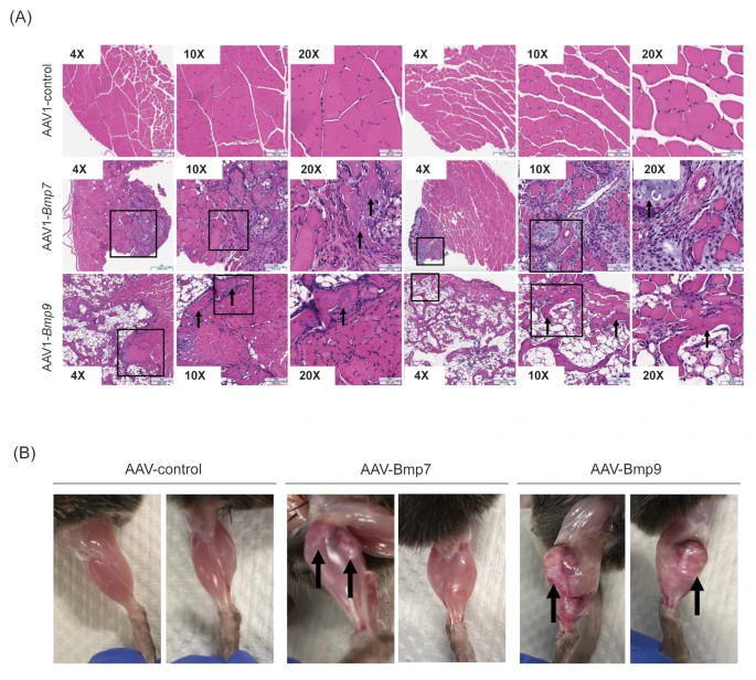 图5:肌肉局部过表达 BMP7 和 BMP9 导致异位骨化