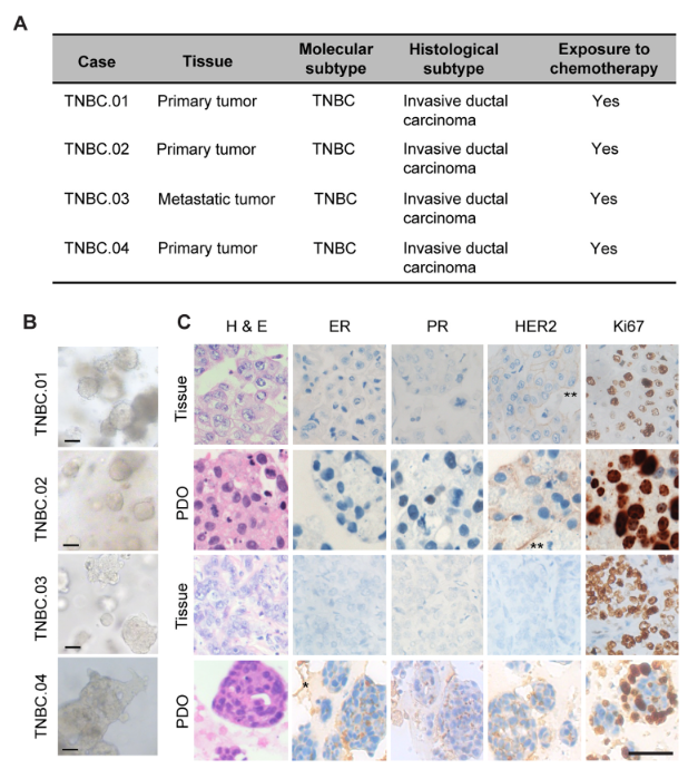 图 1：TNBC 患者来源类器官的表征