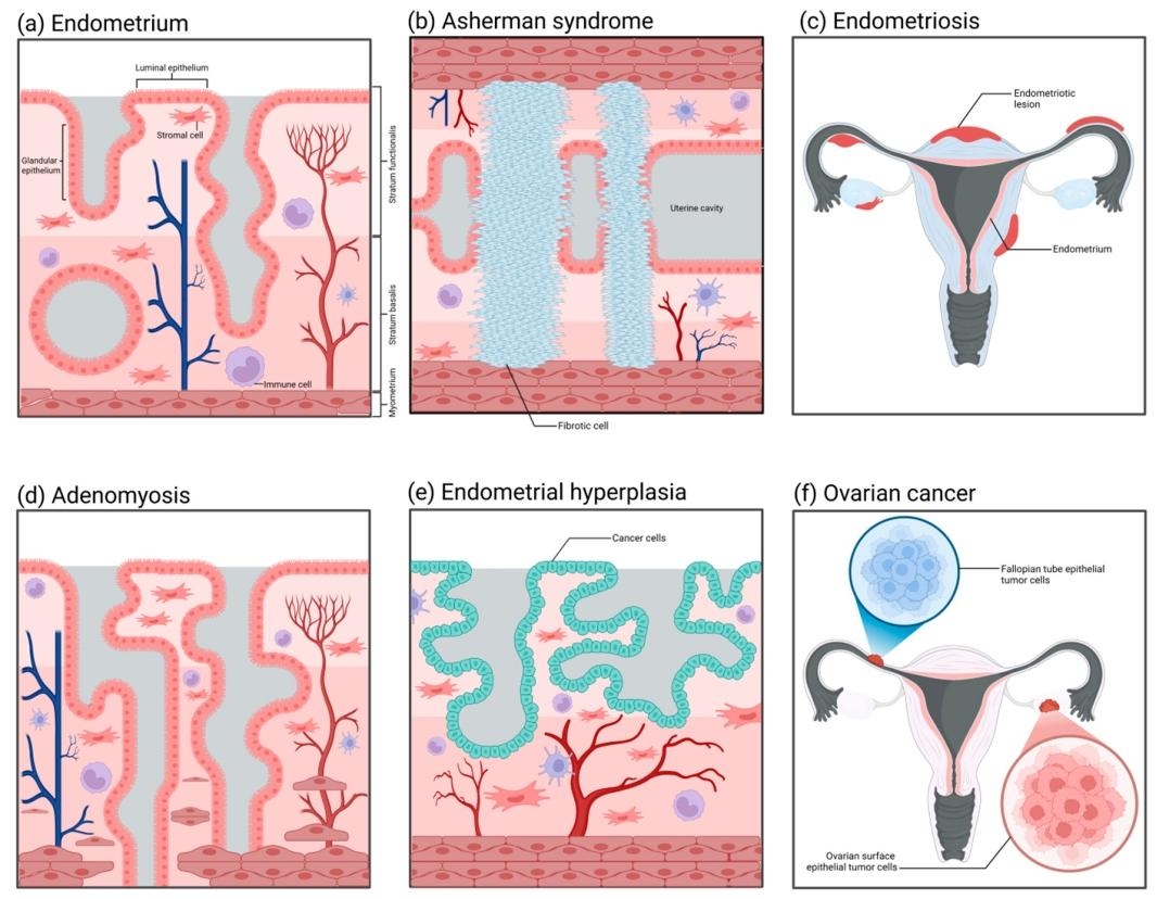 图 4:常见女性生殖道疾病的病理结构