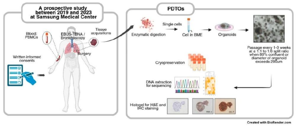 图 1：肺癌 PDTO 的建立流程