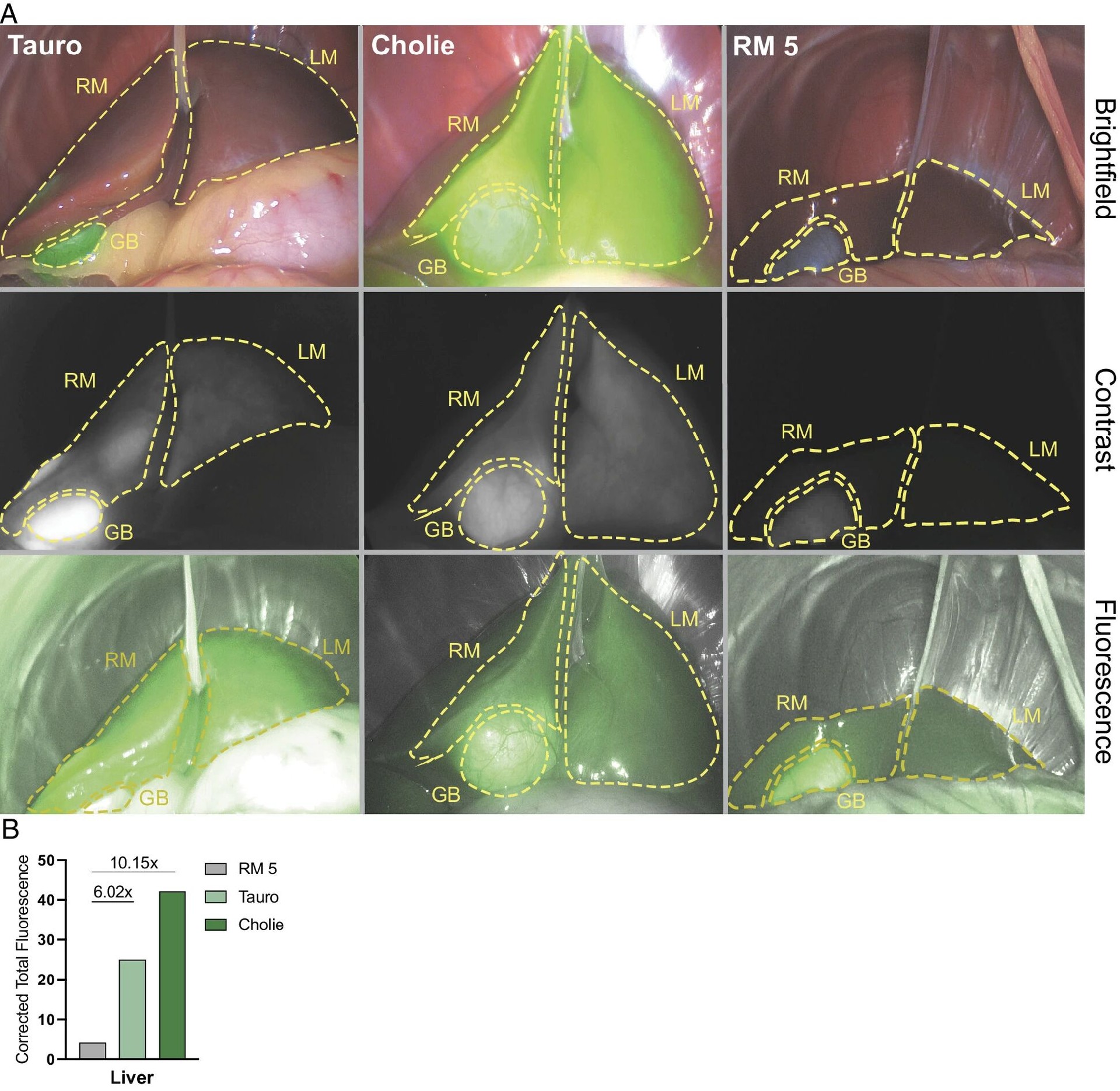 图 3:hNTCP 在体内与 HBV Pre-S1 的结合验证
