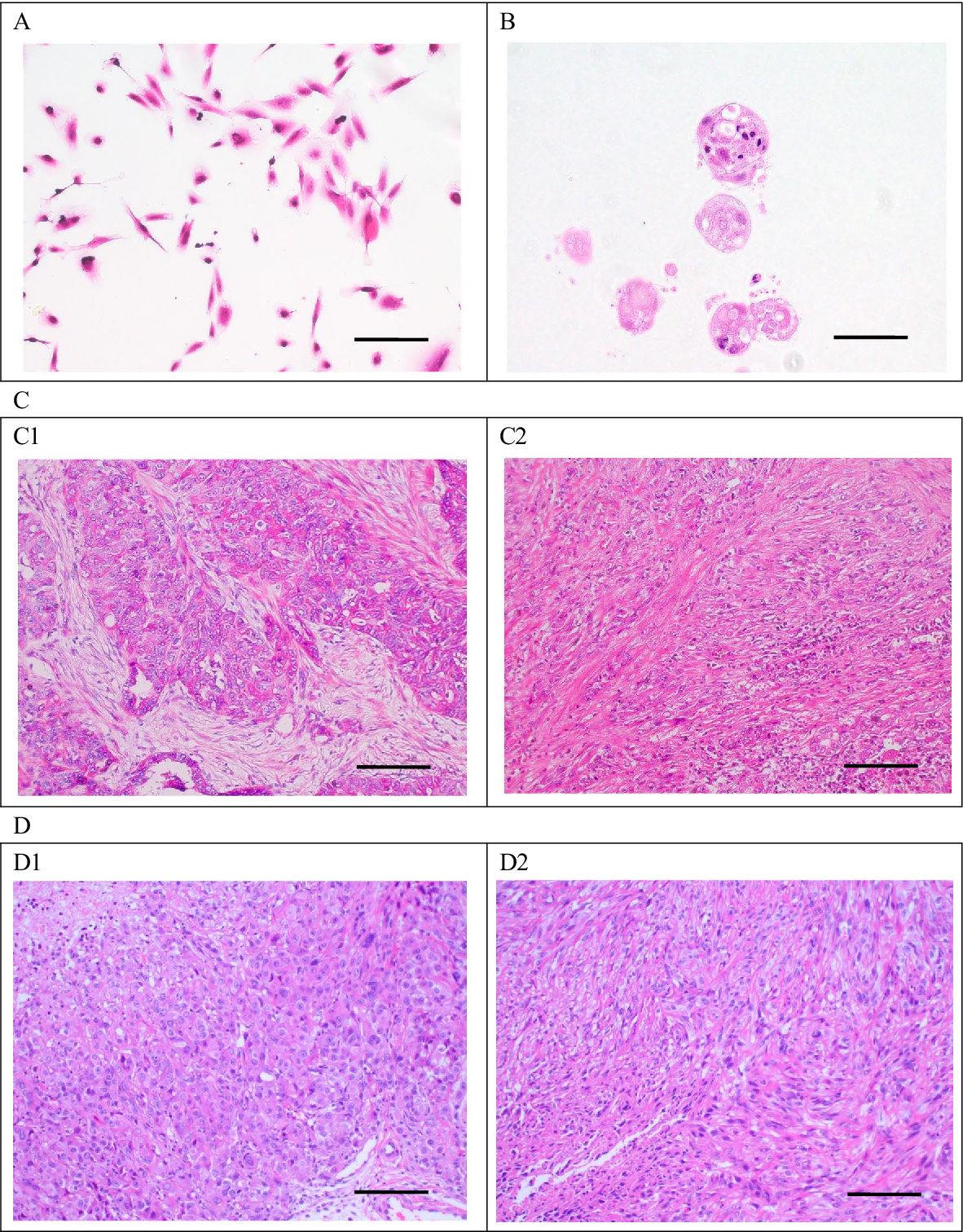 图 5：ICC-X3 细胞、类器官、原发肿瘤及异种移植瘤的 HE 染色