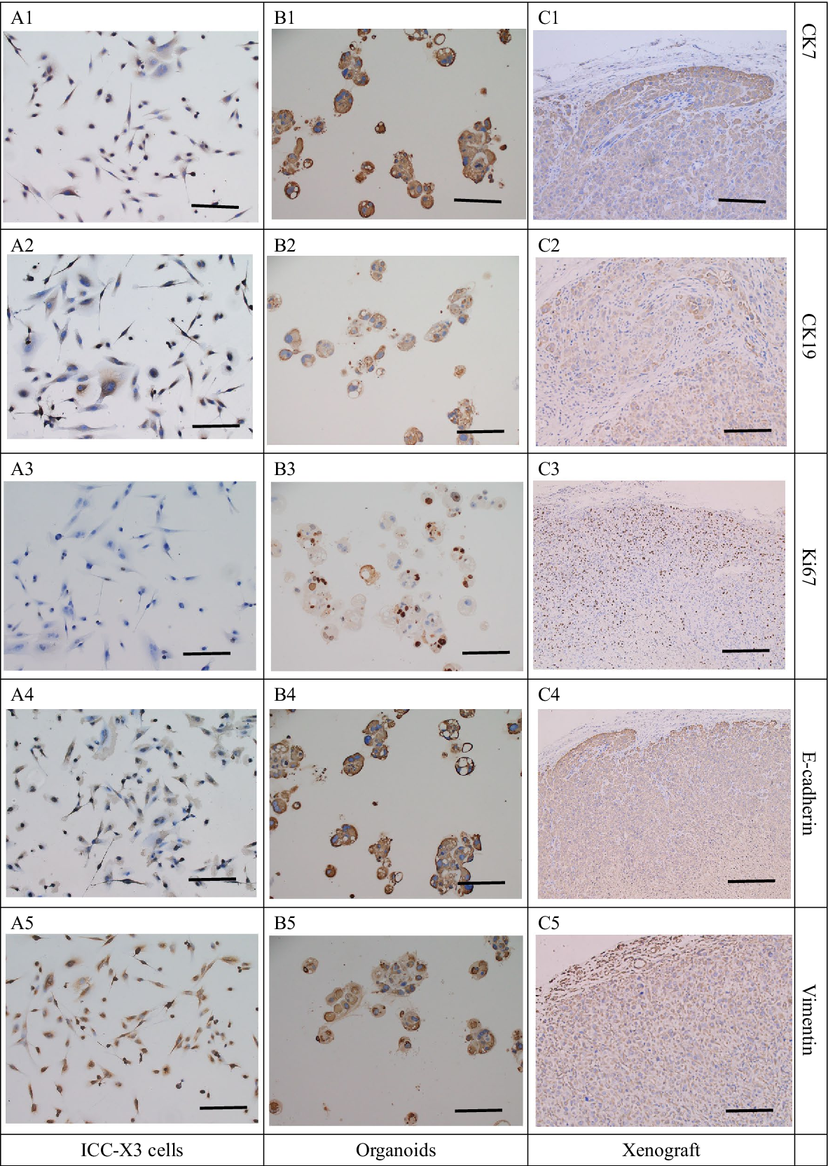 图 6：ICC-X3 细胞、类器官及异种移植瘤的 IHC 染色