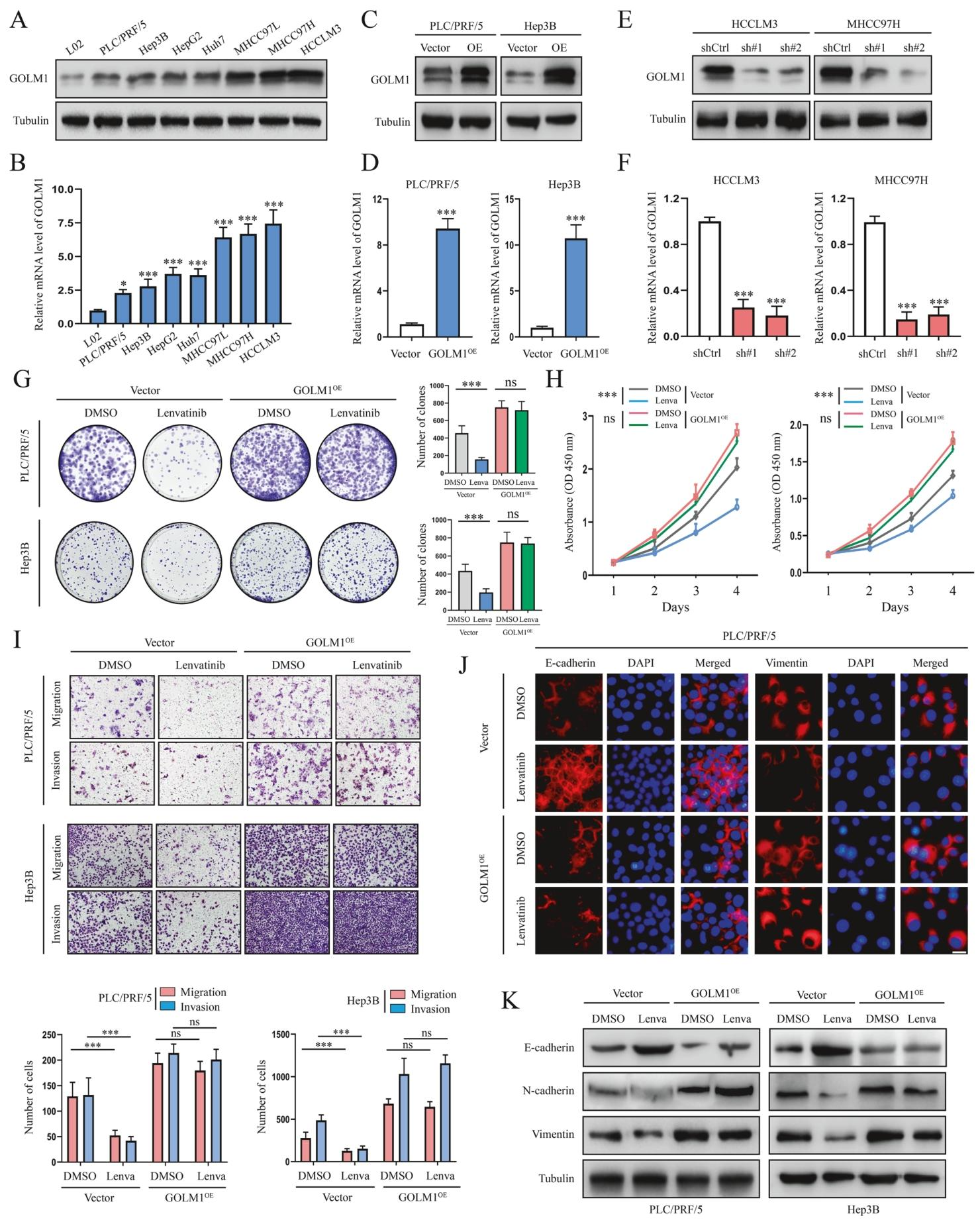 图 2:GOLM1 过表达促进肝癌细胞体外乐伐替尼耐药
