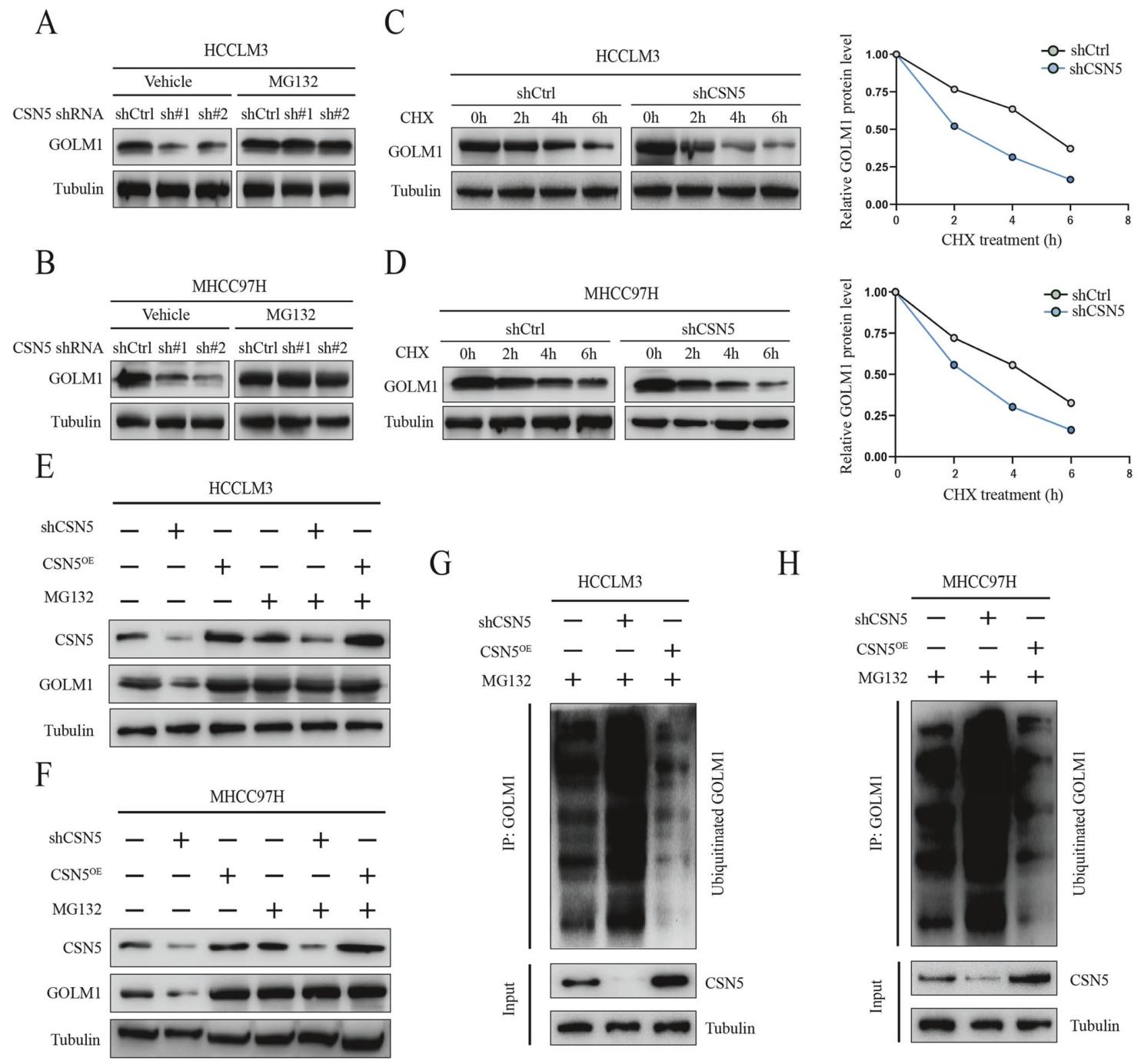 图 6:CSN5 通过去泛素化稳定 GOLM1 蛋白