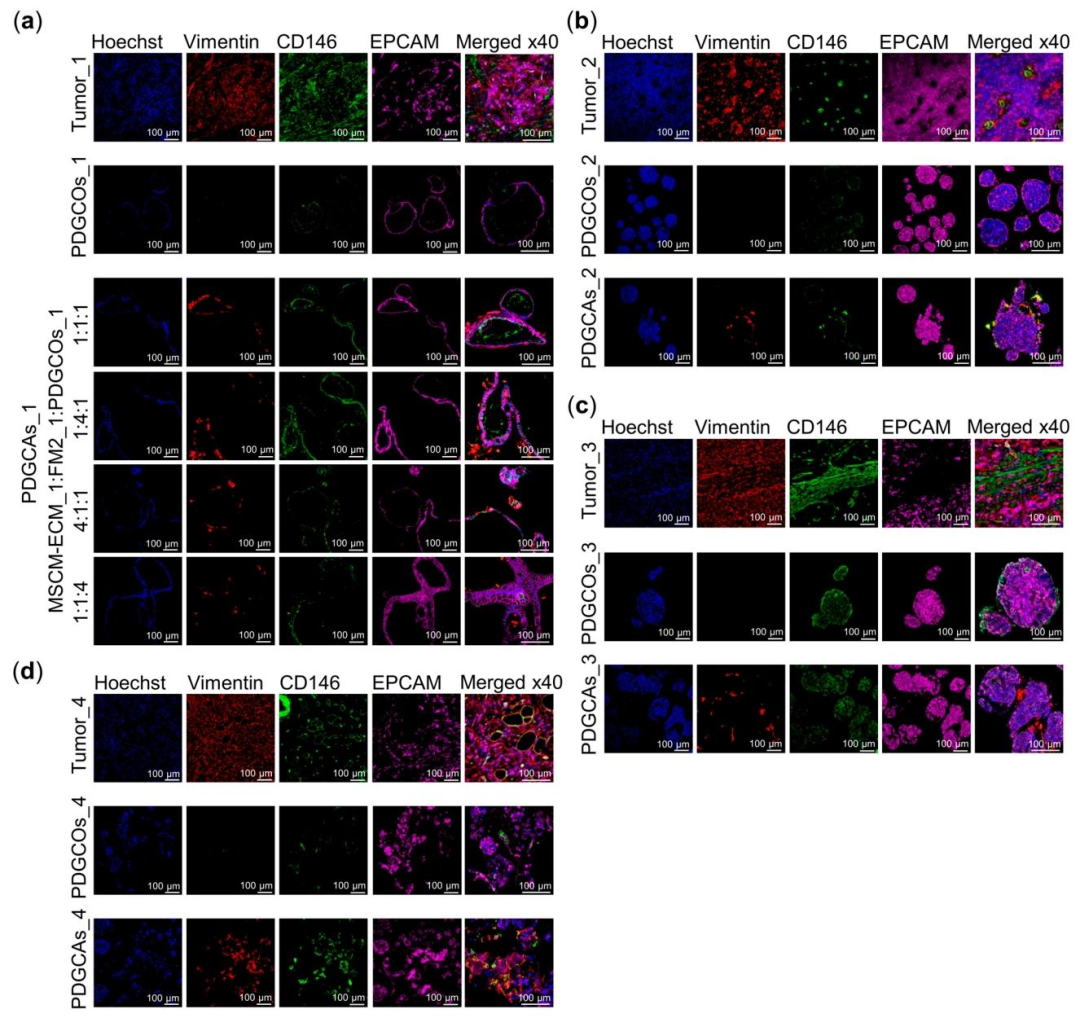 图 5：组装体中上皮与基质标志物的共定位