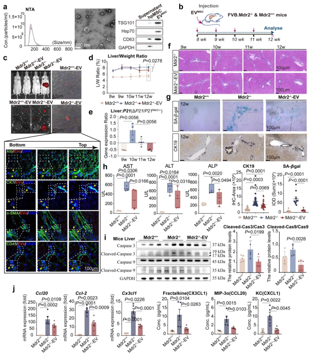 图 1：MSC 来源的 EVs 显著改善 Mdr2-/- 小鼠肝脏状况