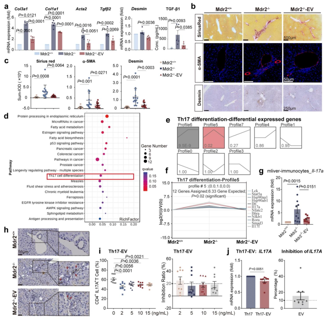 图 2：EVMSC 减轻 Mdr2-/- 小鼠肝纤维化并抑制 Th17 分化