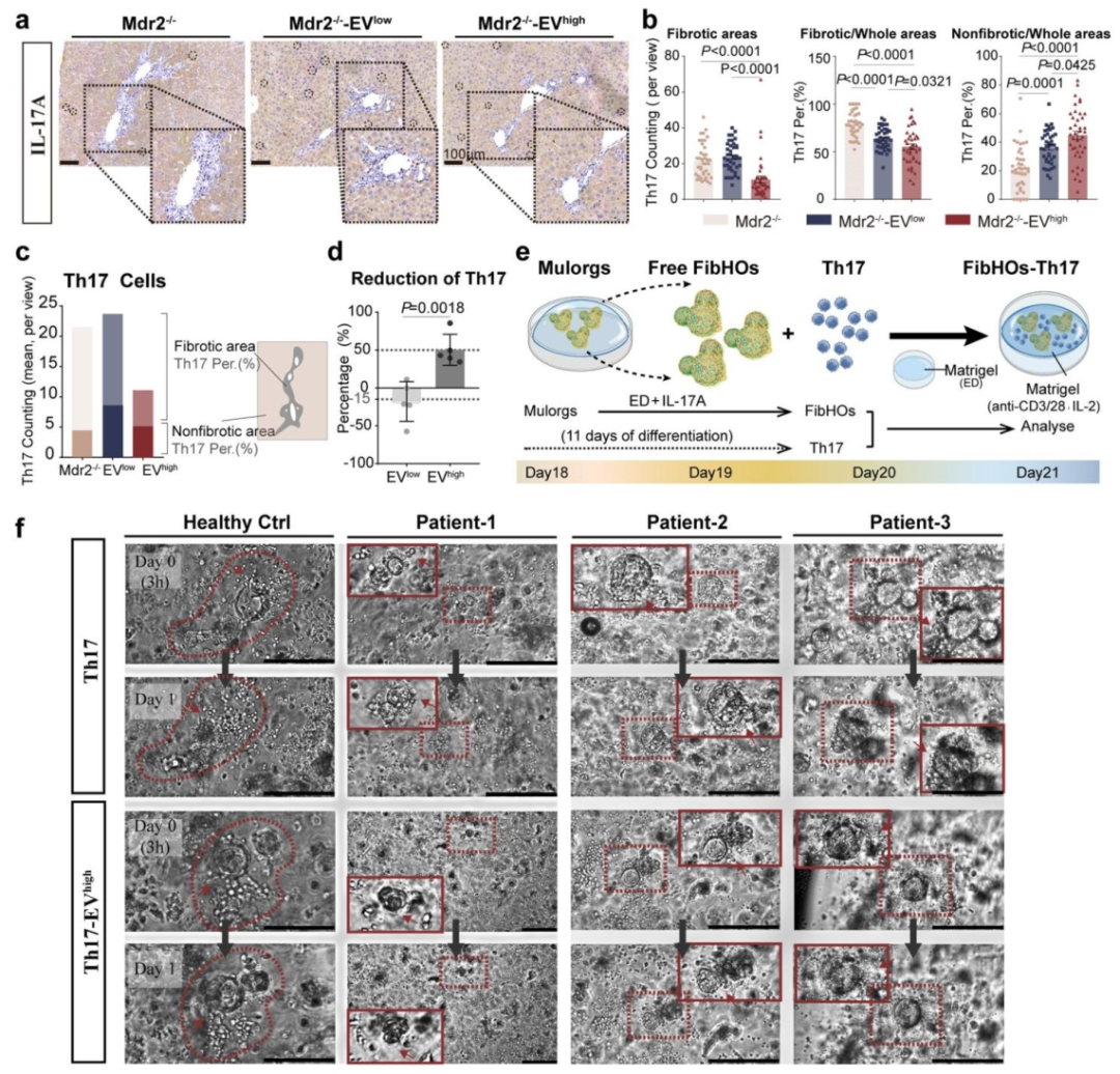 图 7：EVhigh 通过抑制 Th17 分化和迁移改善 PSC 的 Th17 相关纤维化微环境