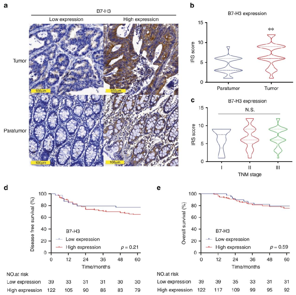 图 1：B7-H3 在 CRC 中的高表达