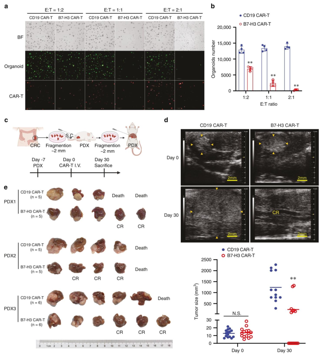 图 4：B7-H3 CAR-T 靶向患者来源模型