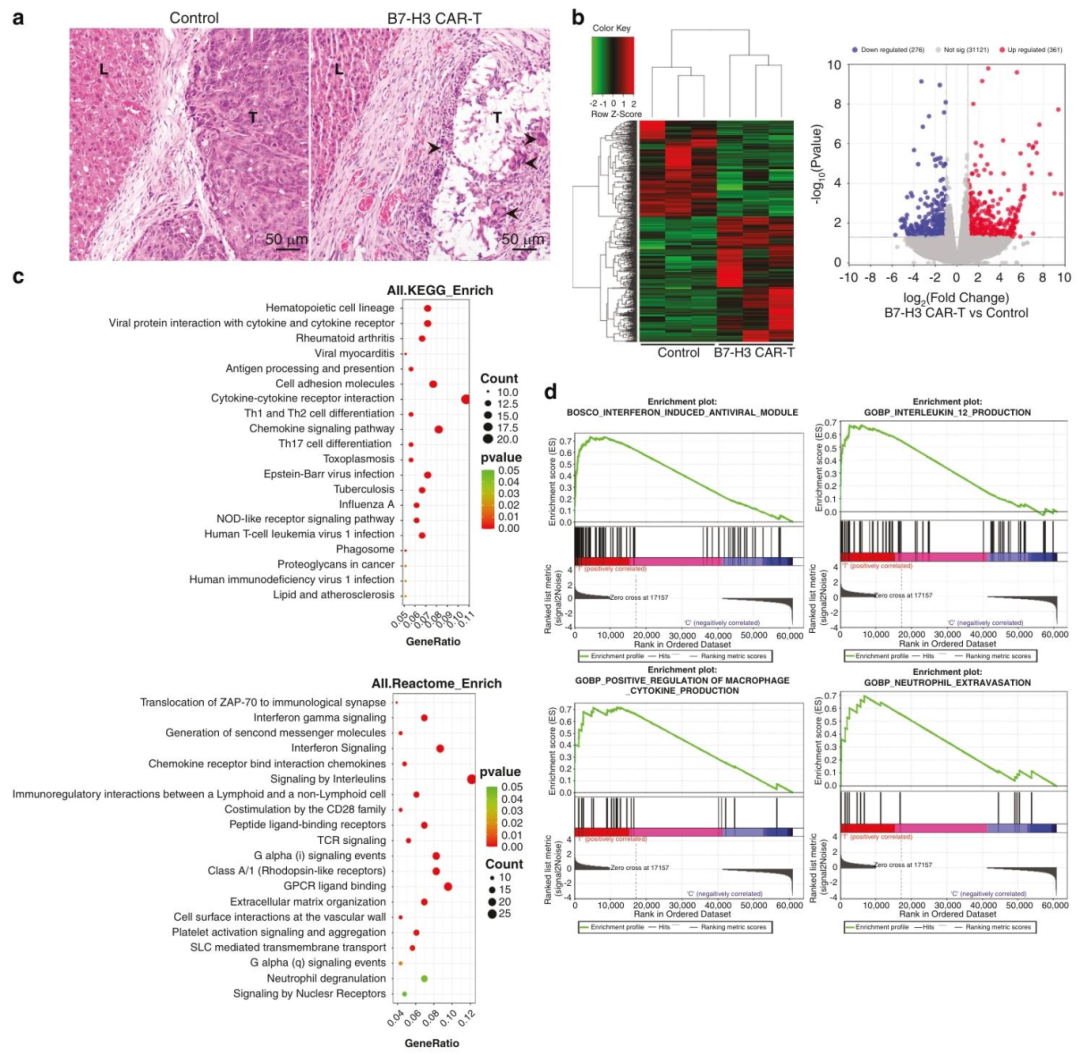 图 5：B7-H3 CAR-T 治疗后的组织学和基因表达变化