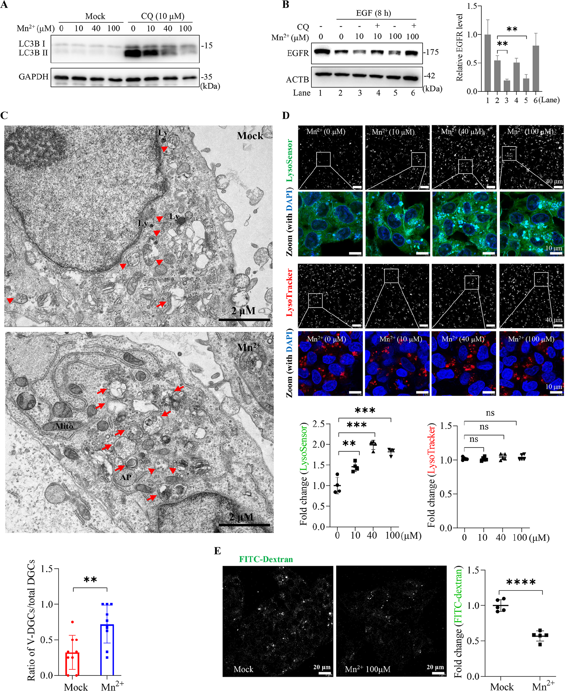 图5：Mn²⁺增强溶酶体活性及酸化