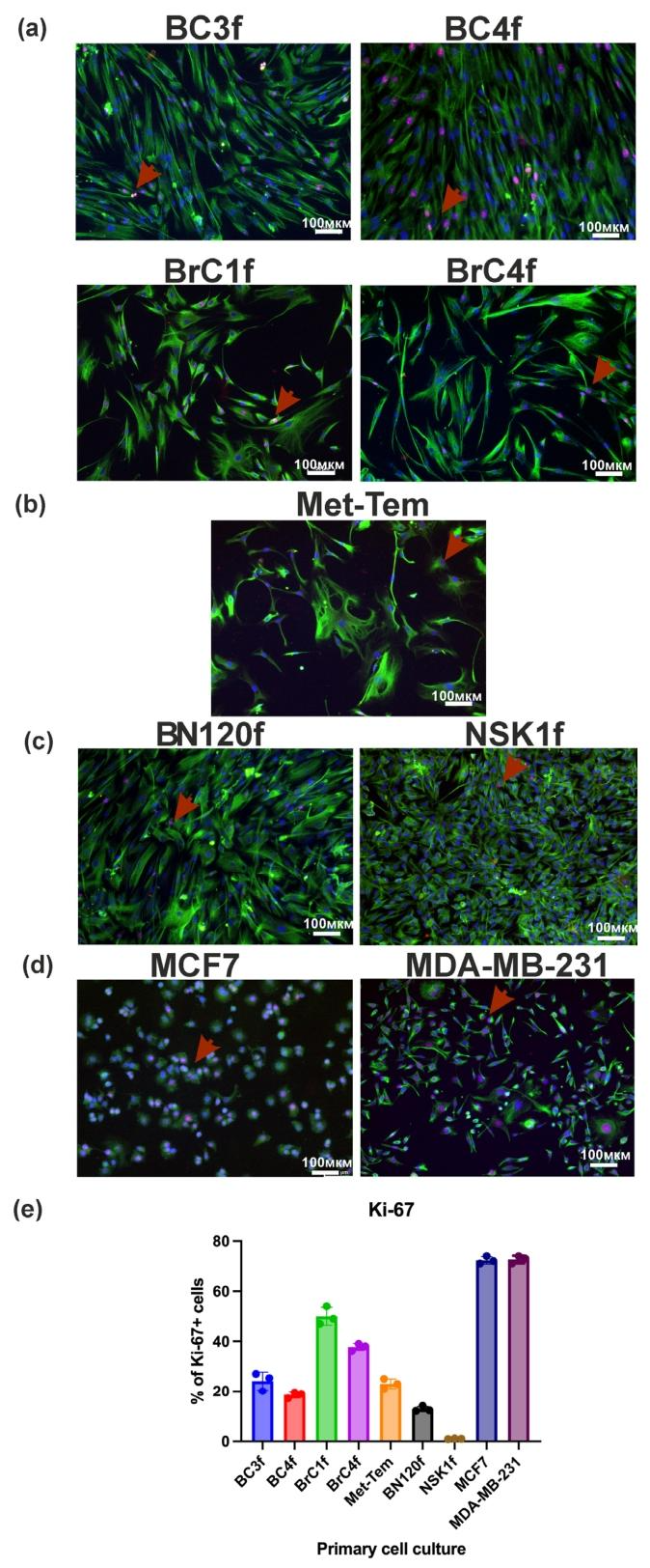 图2：CAF 的 vimentin 与 Ki-67 表达