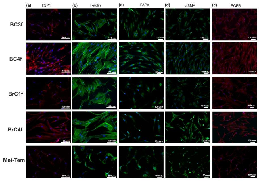 图4：CAF 的特异性标志物免疫荧光