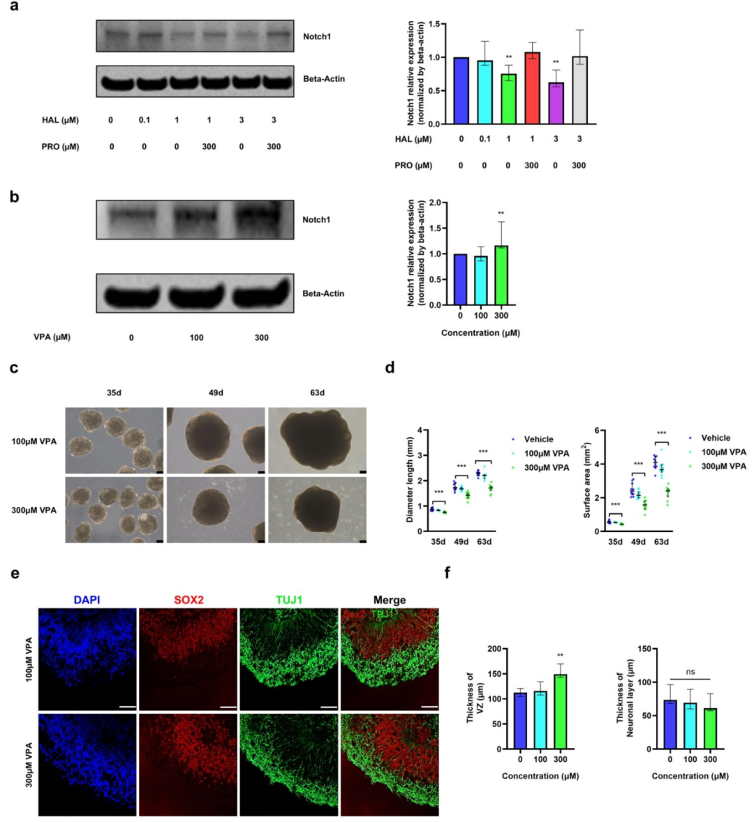 图 4：Notch1 信号在类器官神经发育中的作用