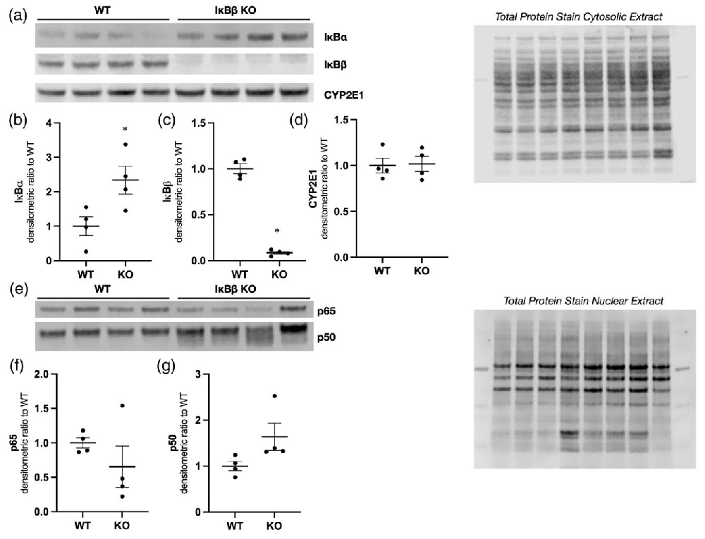图 1：WT 与 IκBβ⁻/⁻小鼠肝组织基础蛋白表达