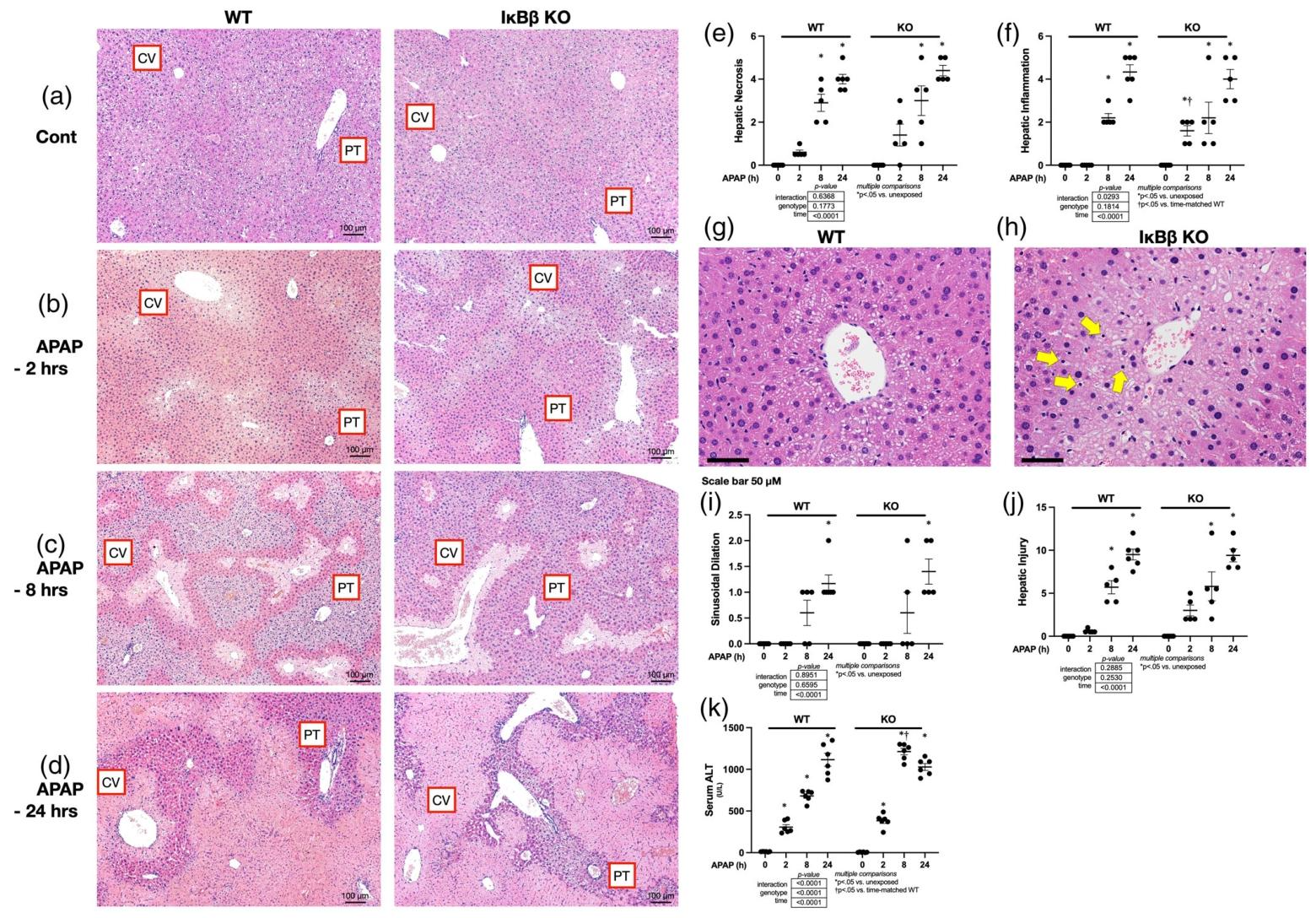 图 2：APAP 诱导的急性肝损伤(2-24 小时)组织学与血清学结果