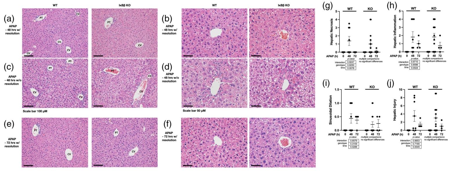 图 4：APAP 诱导的晚期肝损伤恢复(48-72 小时)组织学结果