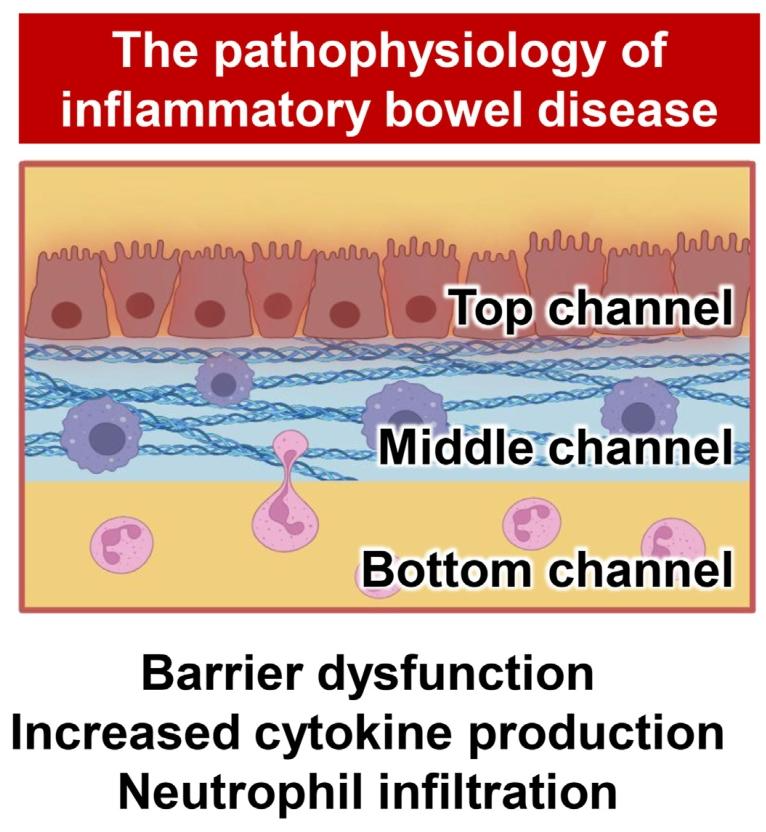 图 3：用于研究炎症性肠病(IBD)的肠道芯片