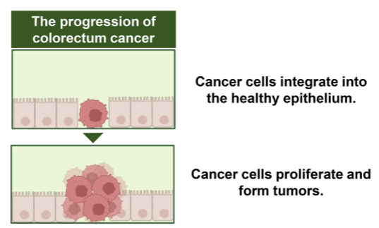 图 4：用于研究结直肠癌(CRC)发生的肠道芯片