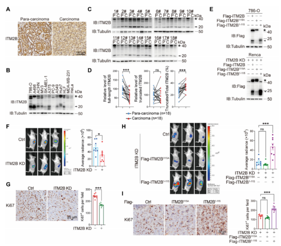图1. 截短型ITM2B促进RCC生长。