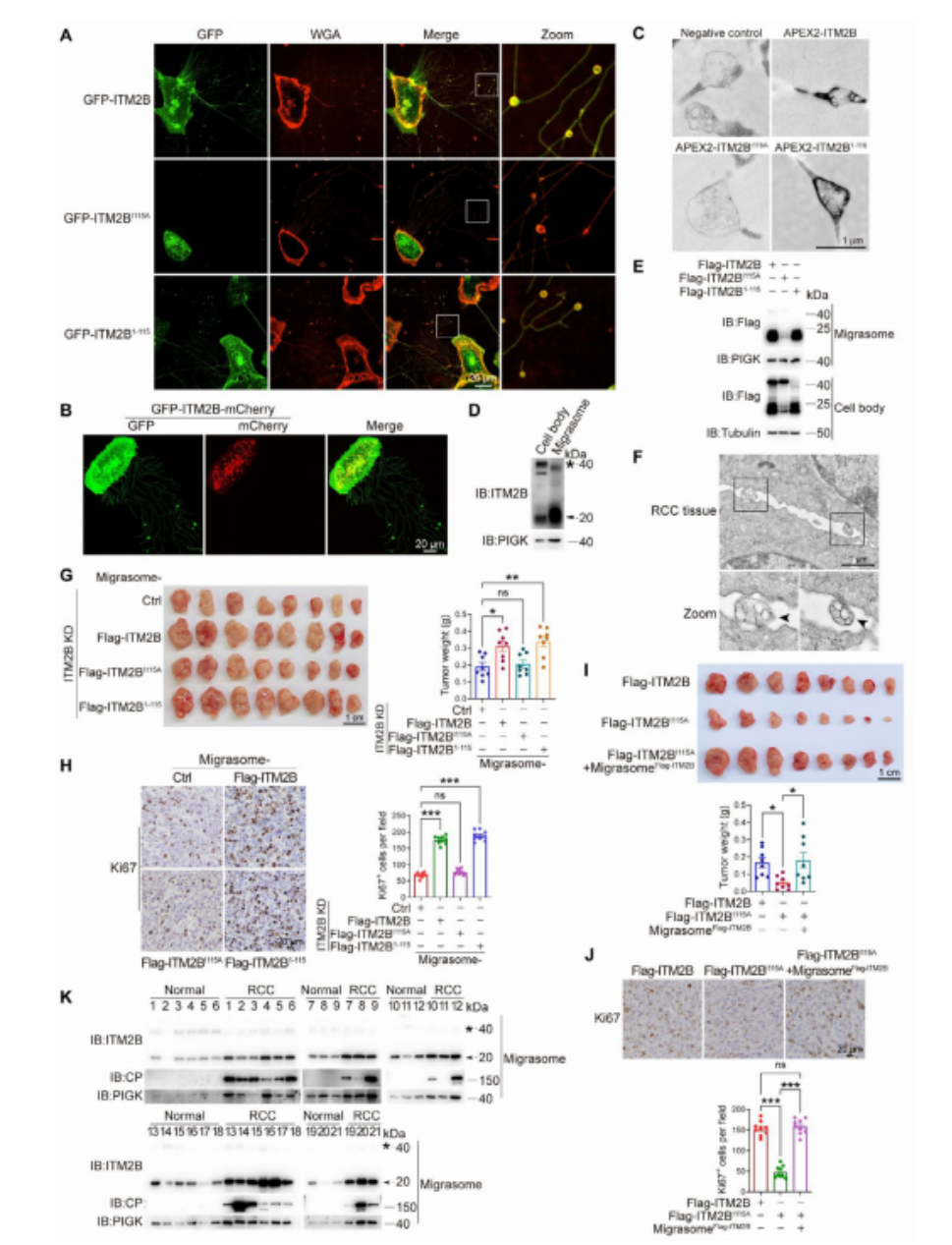图2. ITM2B截短通过迁移体促进RCC生长。