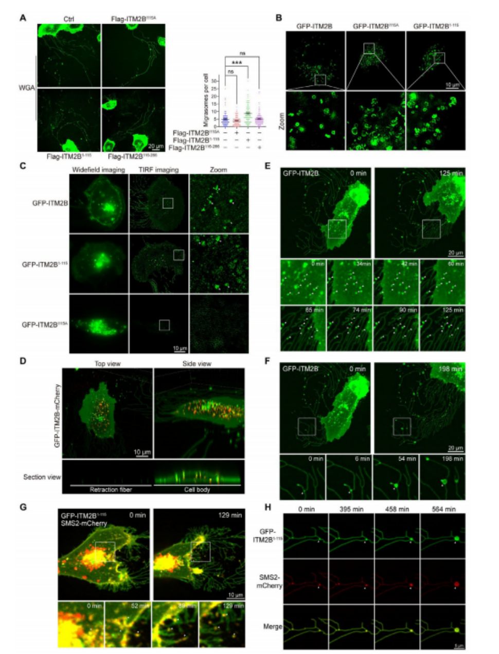 图3. ITM2B截短促进迁移体形成。