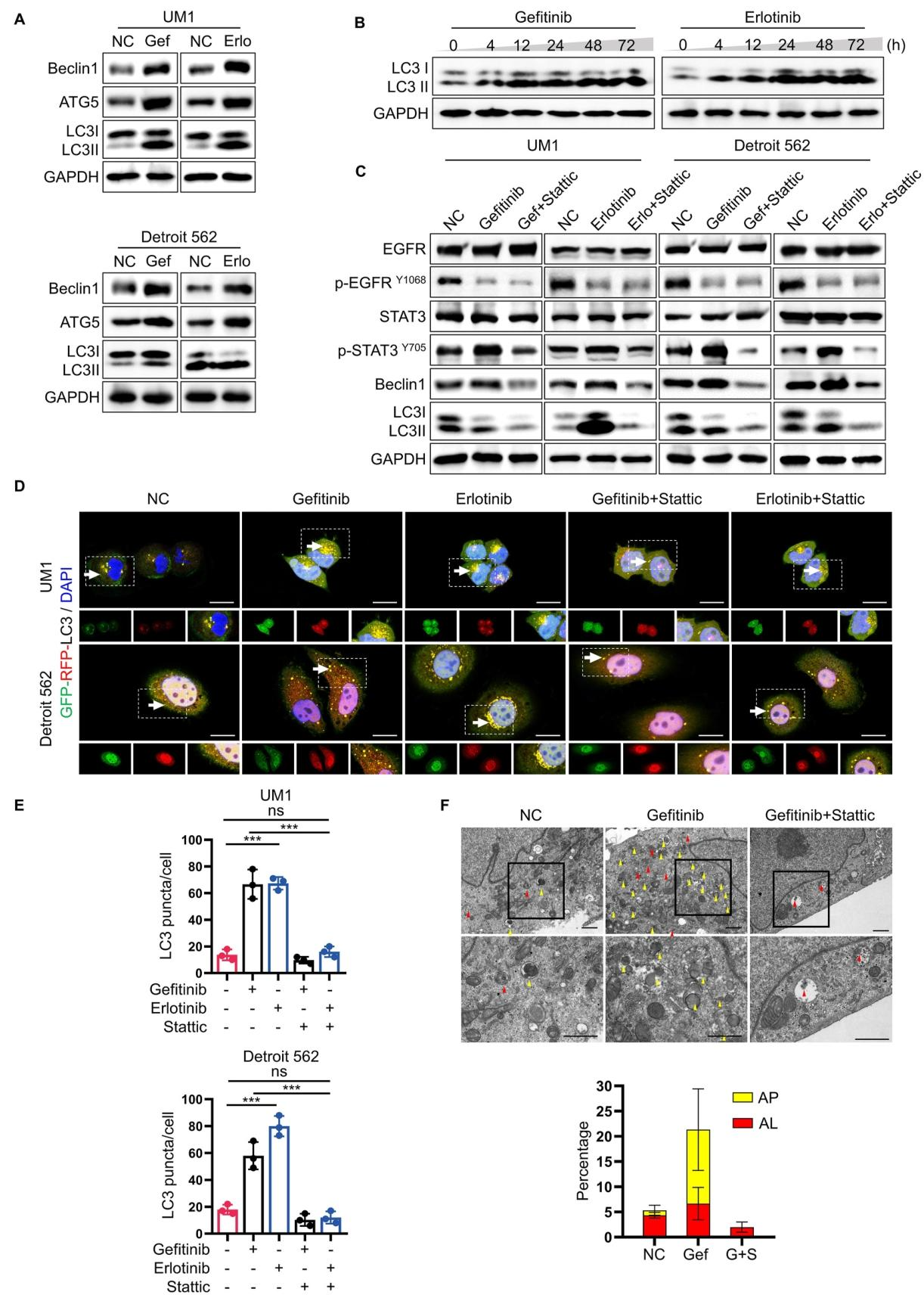 图 5：自噬参与 IL-6/STAT3 介导的耐药
