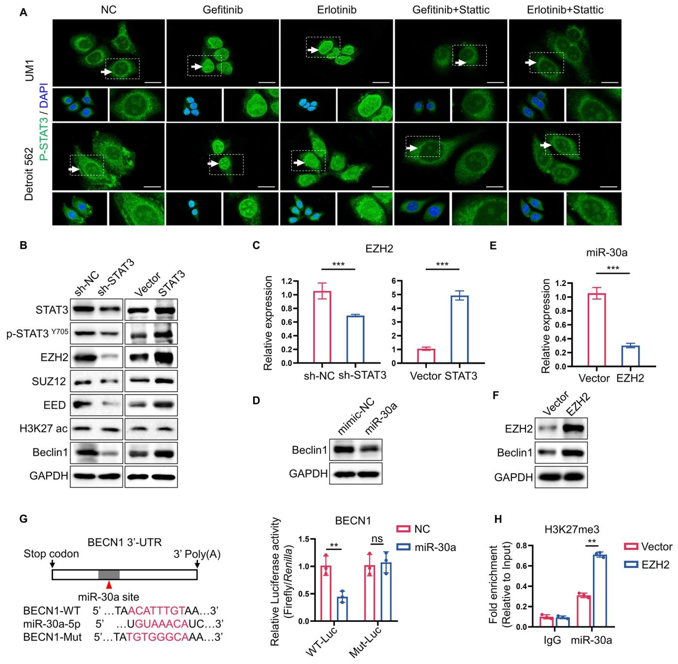 图 6：STAT3 通过 EZH2/miR-30a/Beclin-1 轴调控自噬