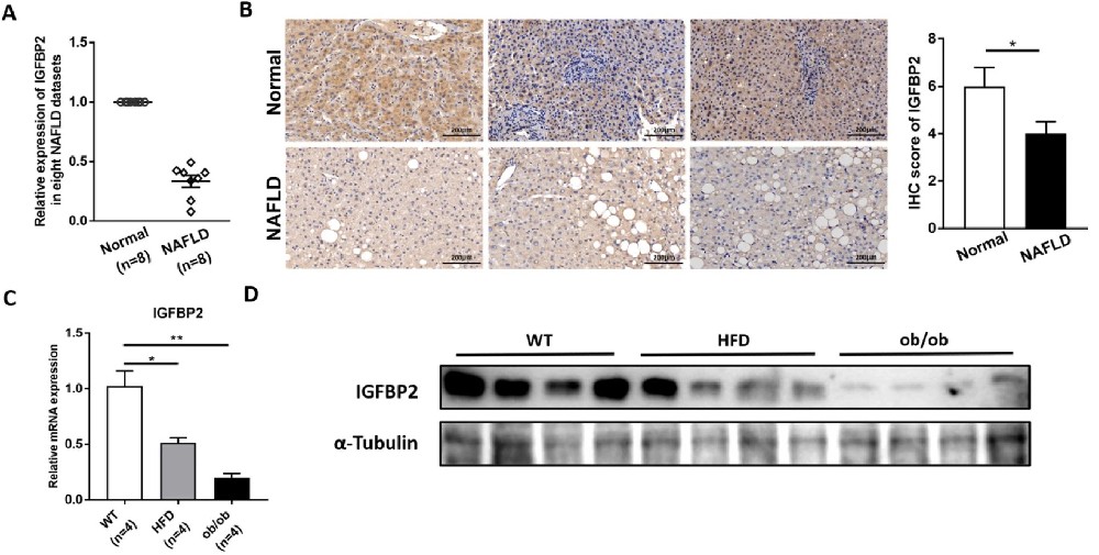 图 1：NAFLD 中 IGFBP2 表达显著下调